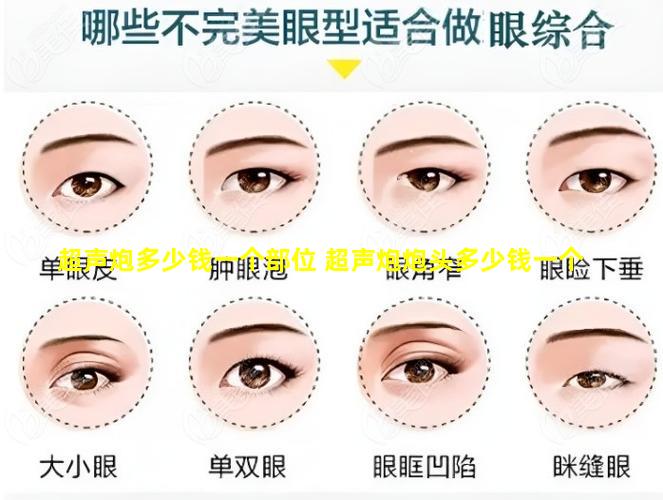 超声炮多少钱一个部位 超声炮炮头多少钱一个